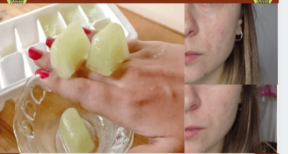 Como usar la papa para las manchas de la cara