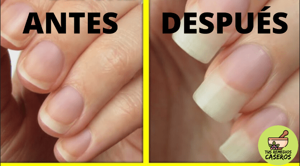 Cómo hacer crecer tus uñas muy rápido y natural