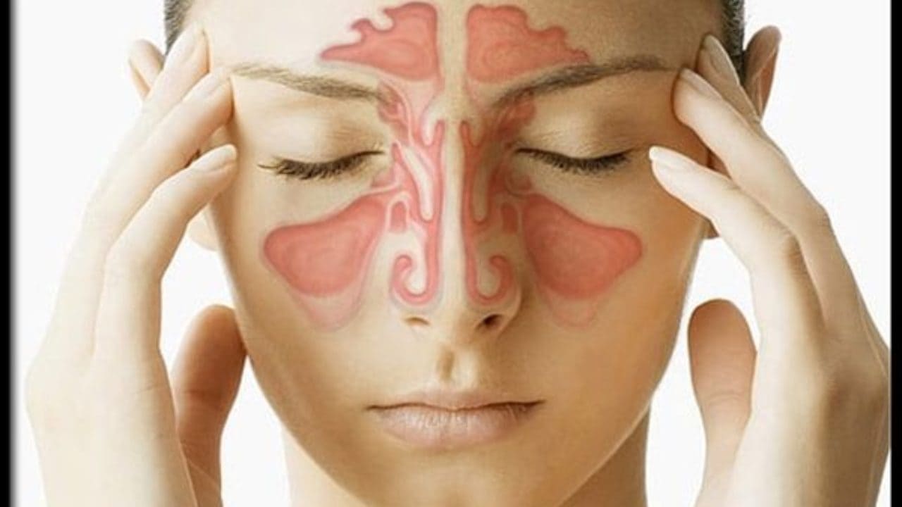 El detonante para la sinusitis y rinitis