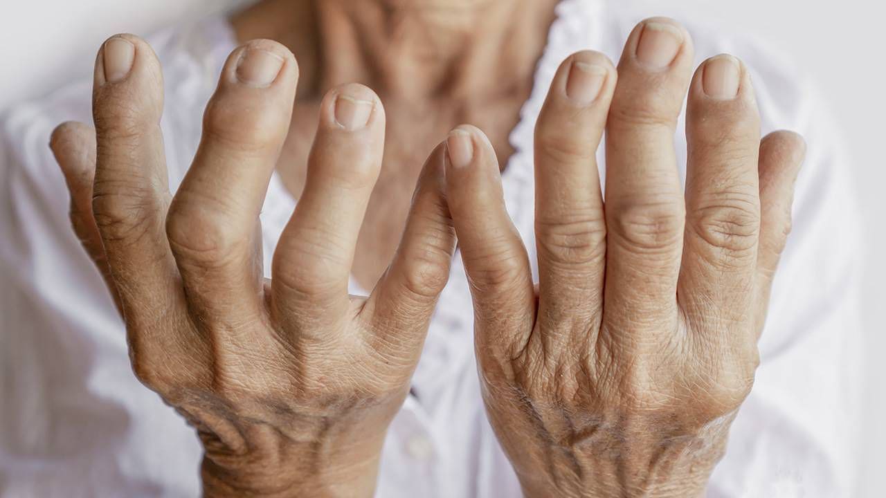 ¡El secreto para vencer la artritis en tan solo 15 días! Descubre el jarabe que cambió mi vida por completo.