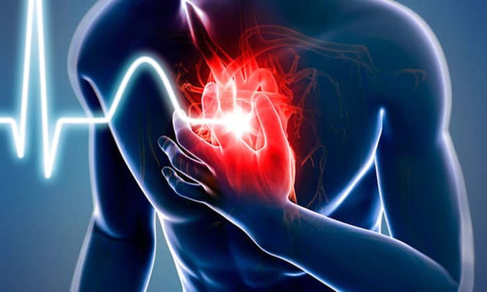 7 señales de un posible infarto: aprenda a identificarlas un mes antes.