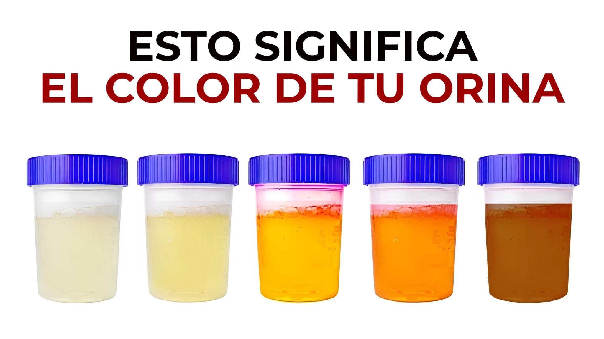 ¿Qué Dice El Color De La Orina Sobre Tu Salud?