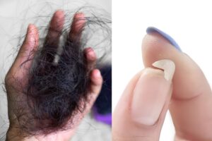 ¿Tienes uñas frágiles y caída del cabello? ¡Mira esto antes de que lo borren!